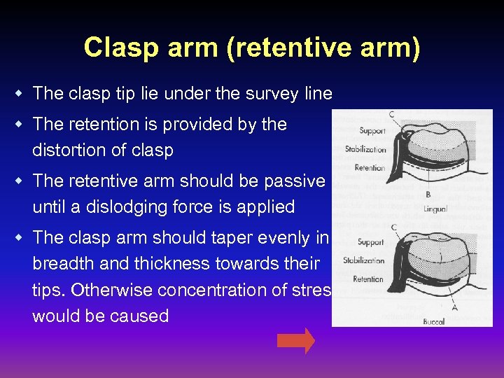 Clasp arm (retentive arm) w The clasp tip lie under the survey line w