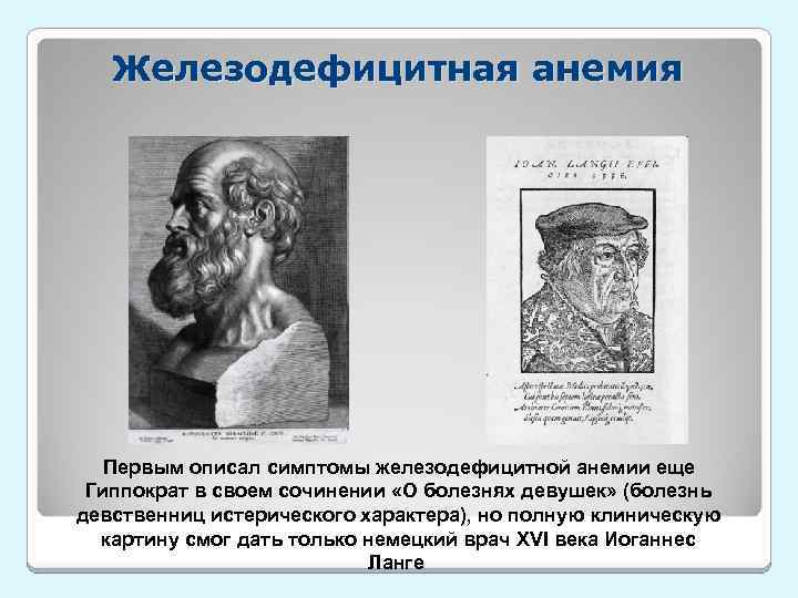Железодефицитная анемия Первым описал симптомы железодефицитной анемии еще Гиппократ в своем сочинении «О болезнях