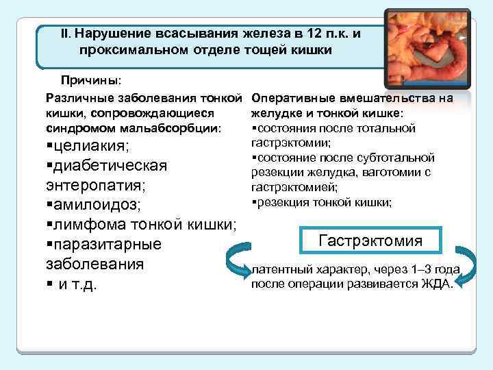 II. Нарушение всасывания железа в 12 п. к. и проксимальном отделе тощей кишки Причины: