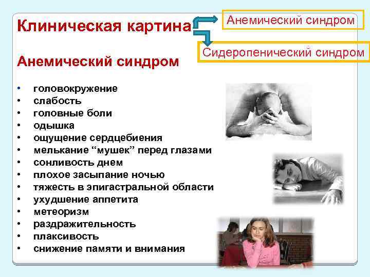 Анемический синдром Клиническая картина Анемический синдром • • • • Сидеропенический синдром головокружение слабость