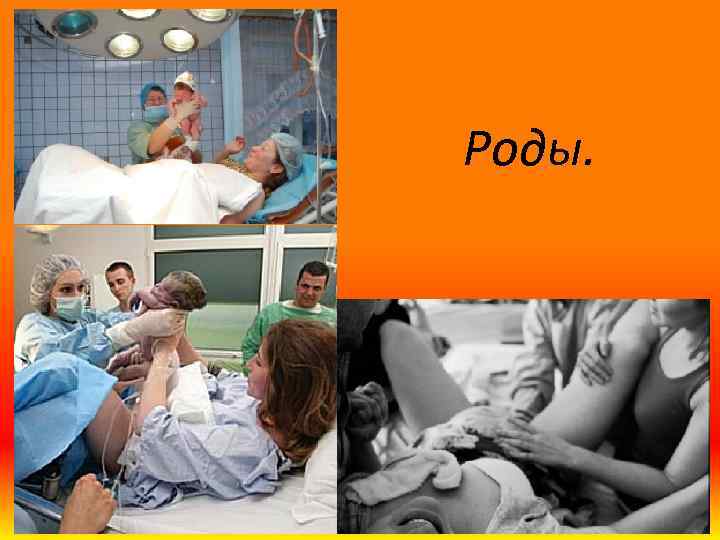 Роды. 