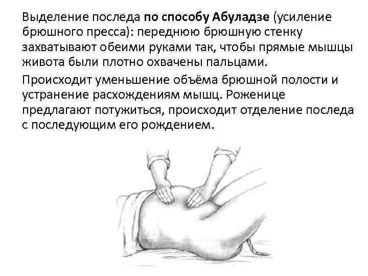 Выделение последа по способу Абуладзе (усиление брюшного пресса): переднюю брюшную стенку захватывают обеими руками