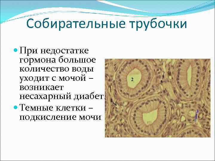 Собирательные трубочки При недостатке гормона большое количество воды уходит с мочой – возникает несахарный