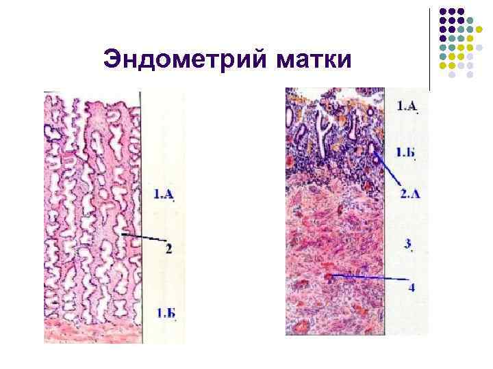 Эндометрий матки 