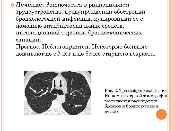  Лечение. Заключается в рациональном трудоустройстве, предупреждении обострений бронхолегочной инфекции, купировании ее с помощью