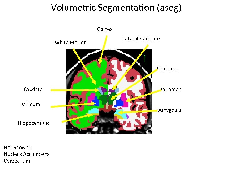 Volumetric Segmentation (aseg) Cortex White Matter Lateral Ventricle Thalamus Caudate Pallidum Hippocampus Not Shown: