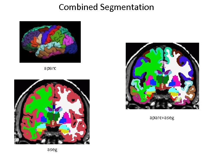 Combined Segmentation aparc+aseg 