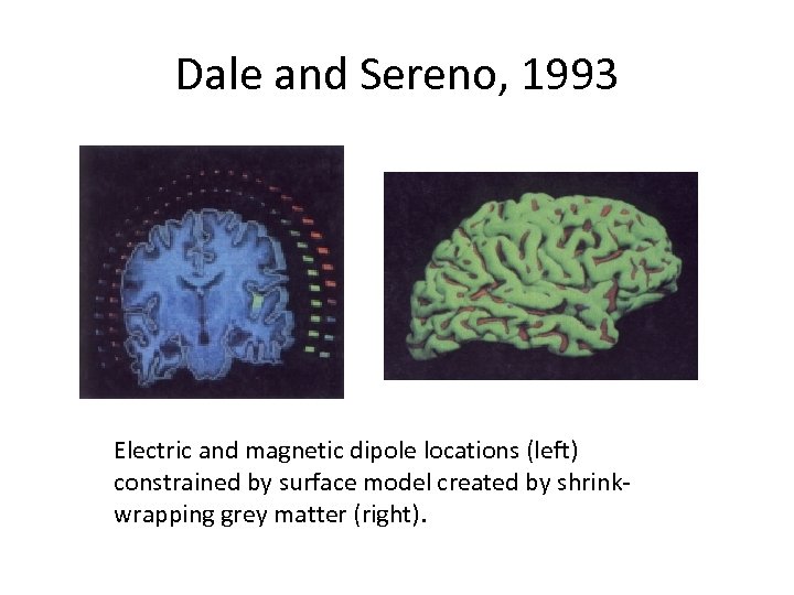 Dale and Sereno, 1993 Electric and magnetic dipole locations (left) constrained by surface model