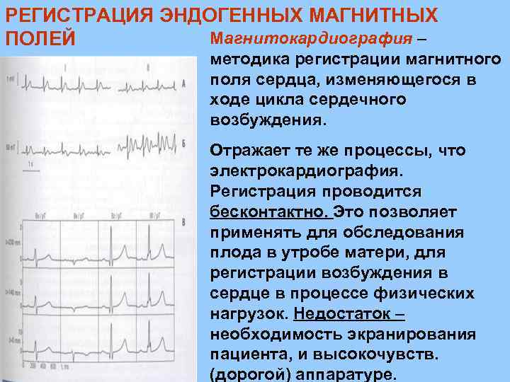 РЕГИСТРАЦИЯ ЭНДОГЕННЫХ МАГНИТНЫХ Магнитокардиография – ПОЛЕЙ методика регистрации магнитного поля сердца, изменяющегося в ходе