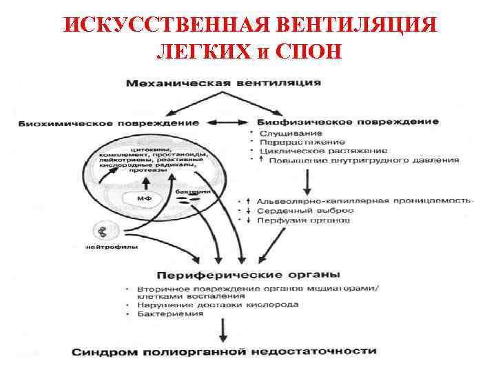 ИСКУССТВЕННАЯ ВЕНТИЛЯЦИЯ ЛЕГКИХ и СПОН 