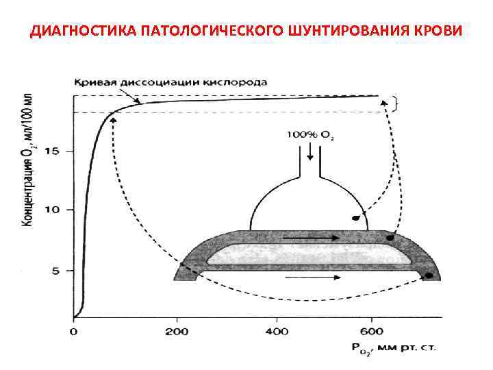 ДИАГНОСТИКА ПАТОЛОГИЧЕСКОГО ШУНТИРОВАНИЯ КРОВИ 