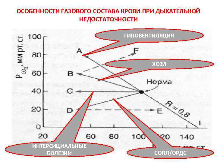 ОСОБЕННОСТИ ГАЗОВОГО СОСТАВА КРОВИ ПРИ ДЫХАТЕЛЬНОЙ НЕДОСТАТОЧНОСТИ ГИПОВЕНТИЛЯЦИЯ ХОЗЛ ИНТЕРСИЦИАЛЬНЫЕ БОЛЕЗНИ СОПЛ/ОРДС 