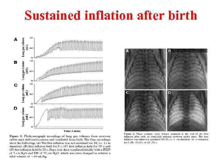 Sustained inflation after birth 