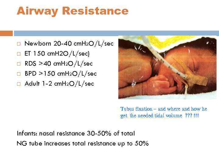 Airway Resistance Newborn 20 -40 cm. H 2 O/L/sec ET 150 cm. H 2