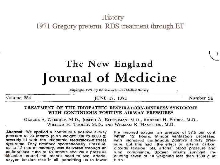 History 1971 Gregory preterm RDS treatment through ET 20 