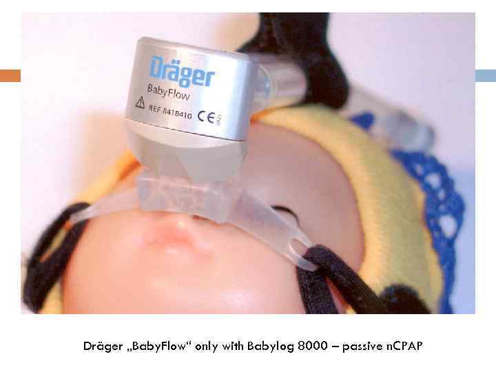 Dräger „Baby. Flow“ only with Babylog 8000 – passive n. CPAP 