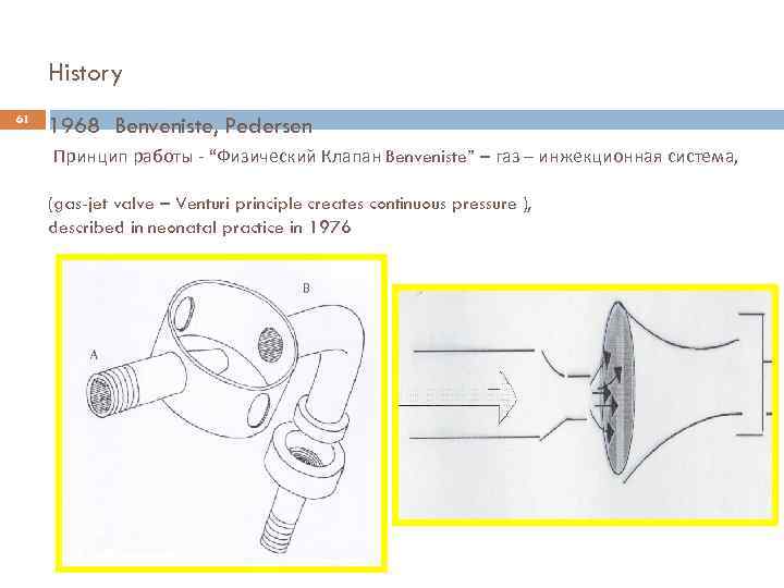 History 61 1968 Benveniste, Pedersen Принцип работы - “Физический Клапан Benveniste” – газ –