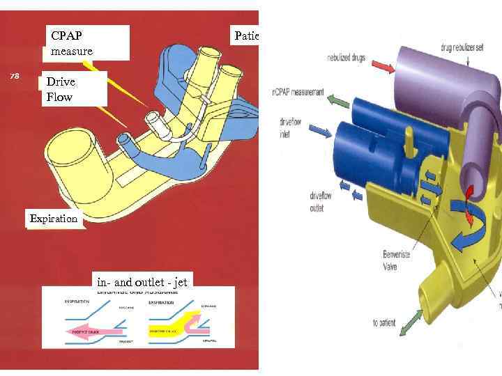 CPAP measure 78 Patient Drive Flow Expiration in- and outlet - jet 