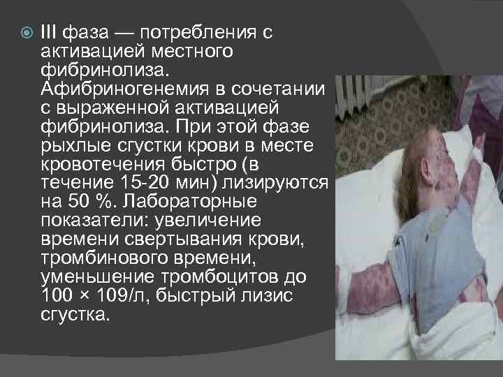  III фаза — потребления с активацией местного фибринолиза. Афибриногенемия в сочетании с выраженной