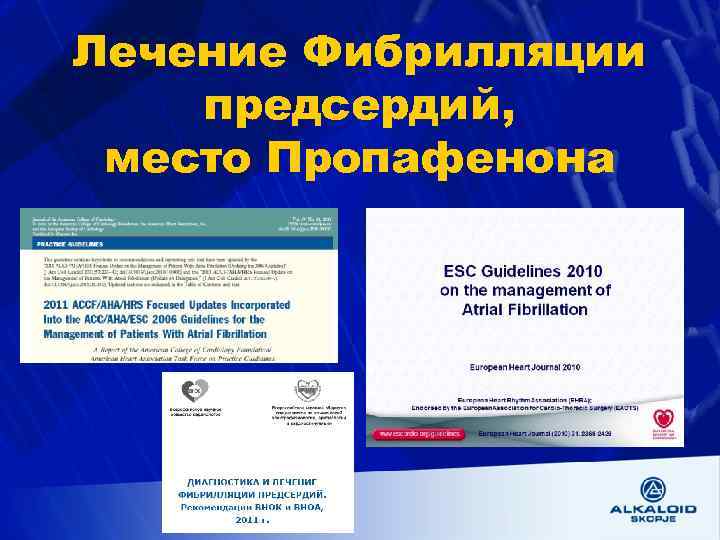 Лечение Фибрилляции предсердий, место Пропафенона 