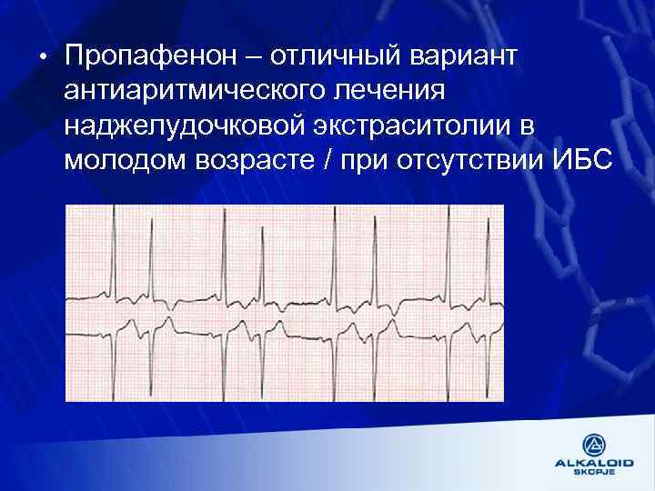  • Пропафенон – отличный вариант антиаритмического лечения наджелудочковой экстраситолии в молодом возрасте /