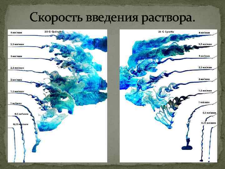 Скорость введения раствора. 