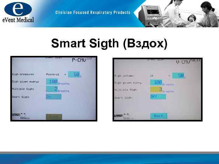 Smart Sigth (Вздох) 