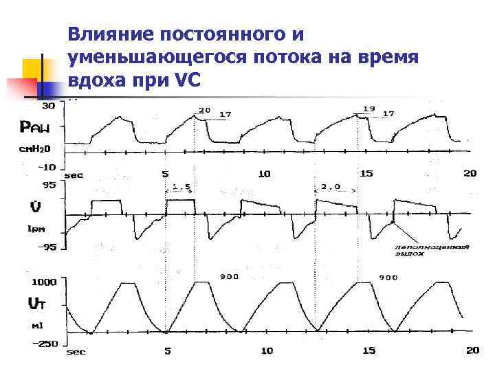 Влияние постоянного и уменьшающегося потока на время вдоха при VC н 