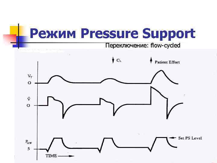 Режим Pressure Support Переключение: flow-cycled 
