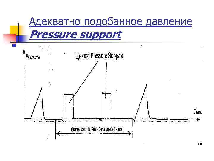 Адекватно подобанное давление Pressure support 