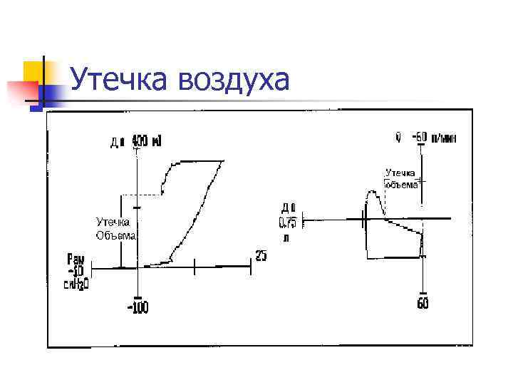 Утечка воздуха 