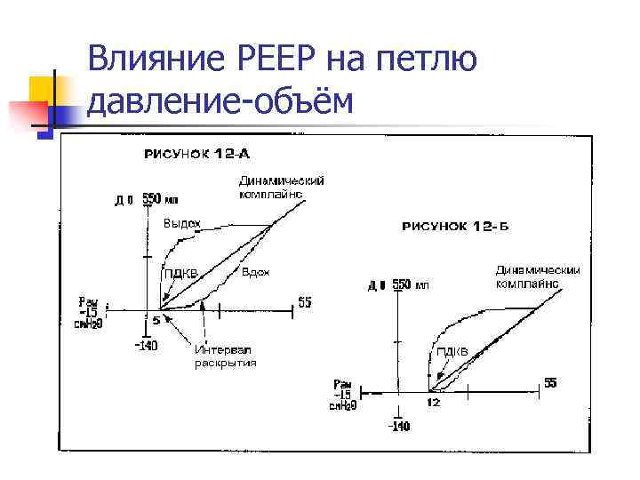 Влияние РЕЕР на петлю давление-объём 