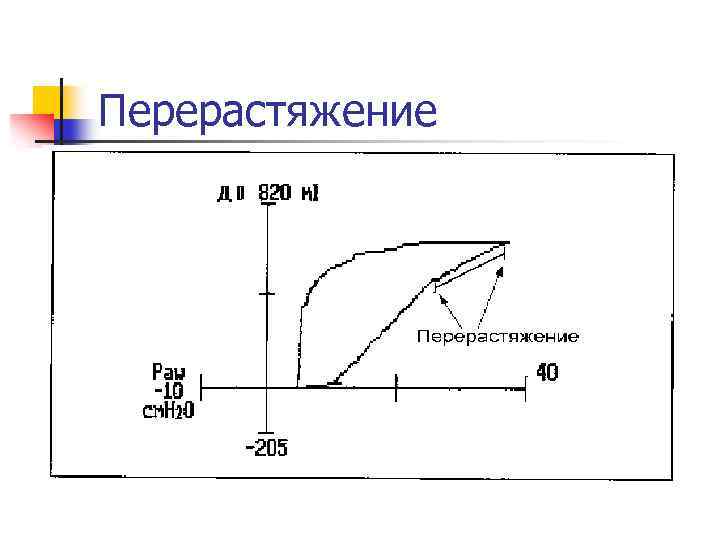 Перерастяжение 