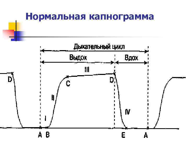 Нормальная капнограмма 