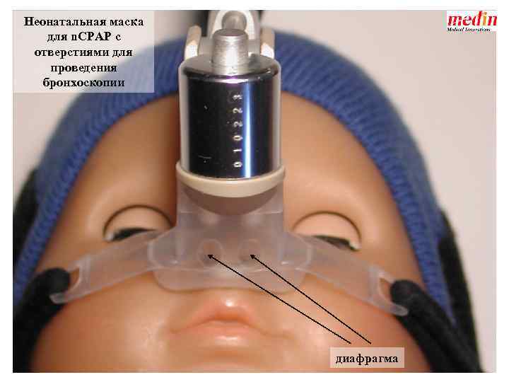 Неонатальная маска для n. CPAP с отверстиями для проведения бронхоскопии диафрагма 