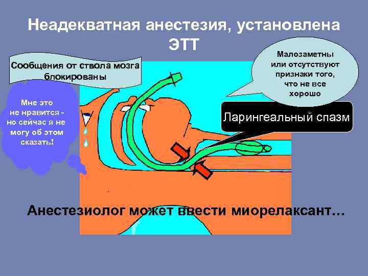 Неадекватная анестезия, установлена ЭТТ Малозаметны Сообщения от ствола мозга блокированы Мне это не нравится
