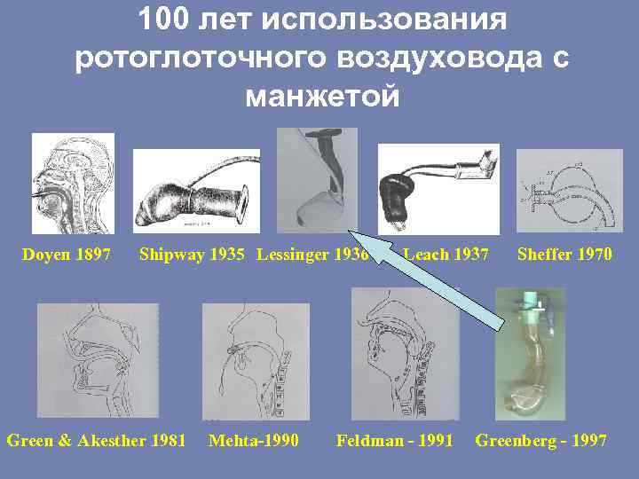 100 лет использования ротоглоточного воздуховода с манжетой Doyen 1897 Shipway 1935 Lessinger 1936 Green
