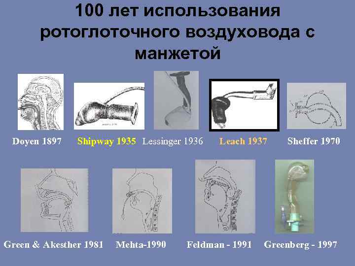 100 лет использования ротоглоточного воздуховода с манжетой Doyen 1897 Shipway 1935 Lessinger 1936 Green