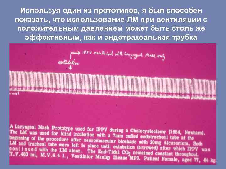 Используя один из прототипов, я был способен показать, что использование ЛМ при вентиляции с
