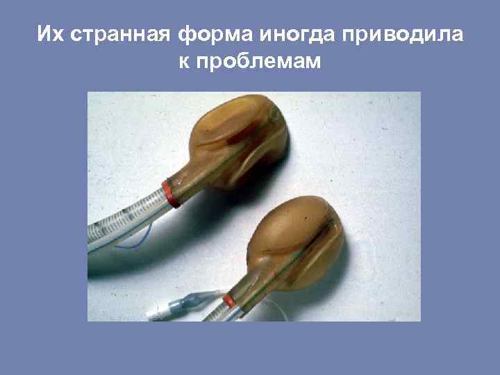 Их странная форма иногда приводила к проблемам 