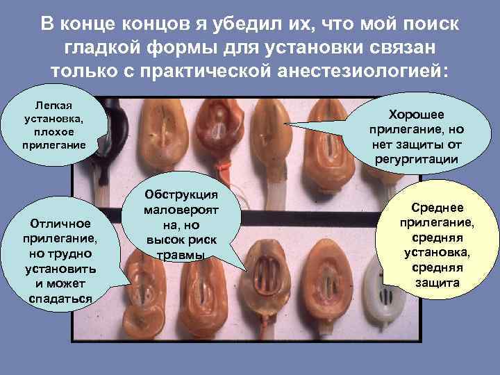 В конце концов я убедил их, что мой поиск гладкой формы для установки связан