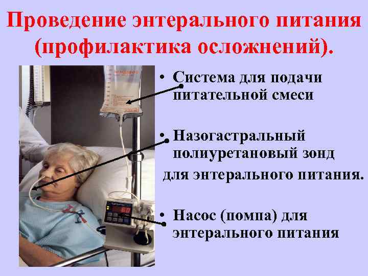 Проведение энтерального питания (профилактика осложнений). • Система для подачи питательной смеси • Назогастральный полиуретановый