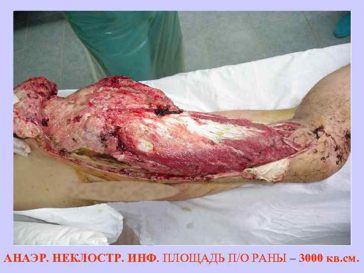 АНАЭР. НЕКЛОСТР. ИНФ. ПЛОЩАДЬ П/О РАНЫ – 3000 кв. см. 