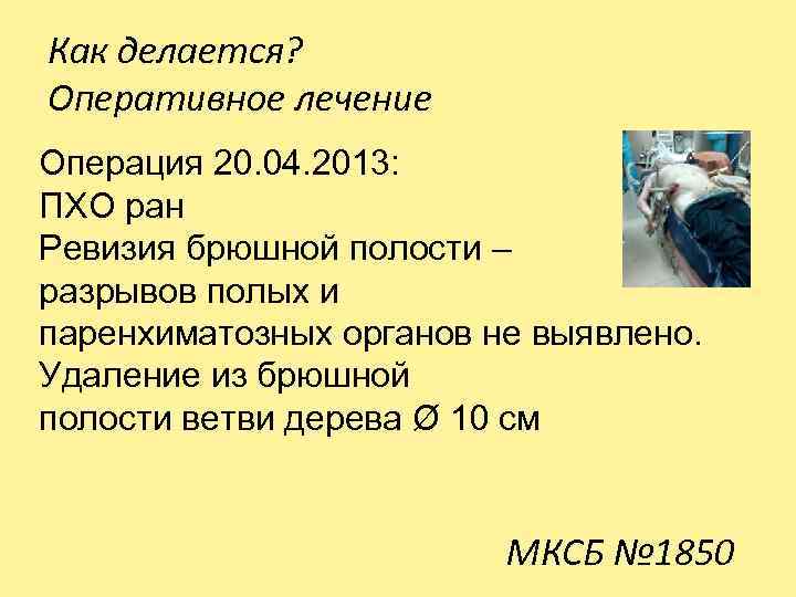 Как делается? Оперативное лечение Операция 20. 04. 2013: ПХО ран Ревизия брюшной полости –