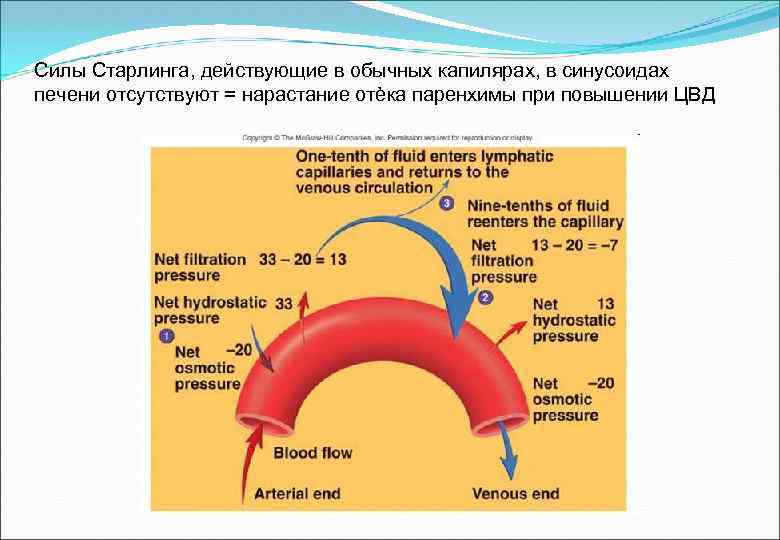 Силы Старлинга, действующие в обычных капилярах, в синусоидах печени отсутствуют = нарастание отѐка паренхимы