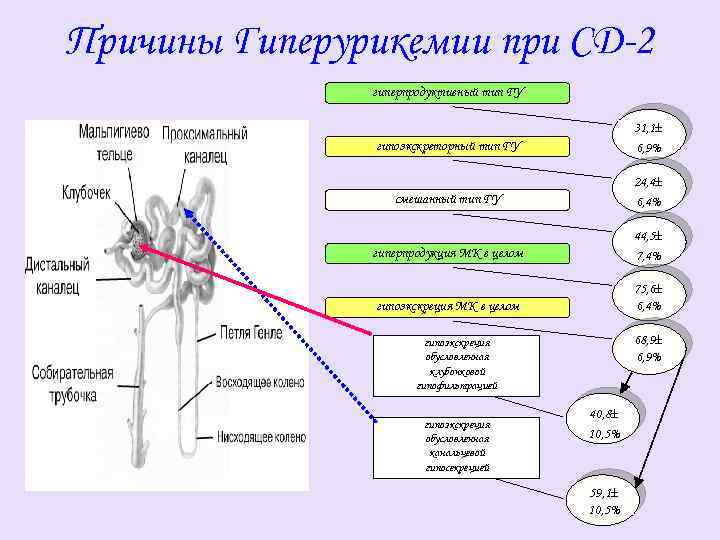 Причины Гиперурикемии при СД-2 гиперпродуктивный тип ГУ гипоэкскреторный тип ГУ 31, 1 6, 9%