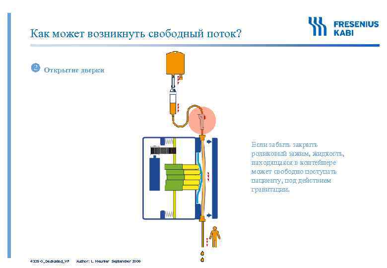 Как может возникнуть свободный поток? Открытие дверки Если забыть закрыть роликовый зажим, жидкость, находящаяся