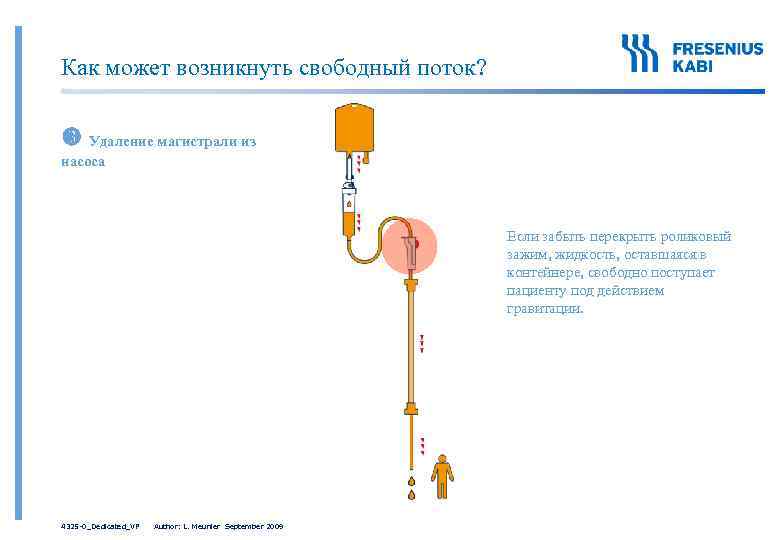 Как может возникнуть свободный поток? Удаление магистрали из насоса Если забыть перекрыть роликовый зажим,