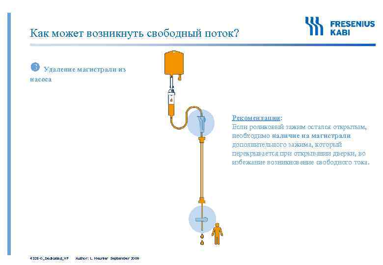 Как может возникнуть свободный поток? Удаление магистрали из насоса Рекомендации: Если роликовый зажим остался
