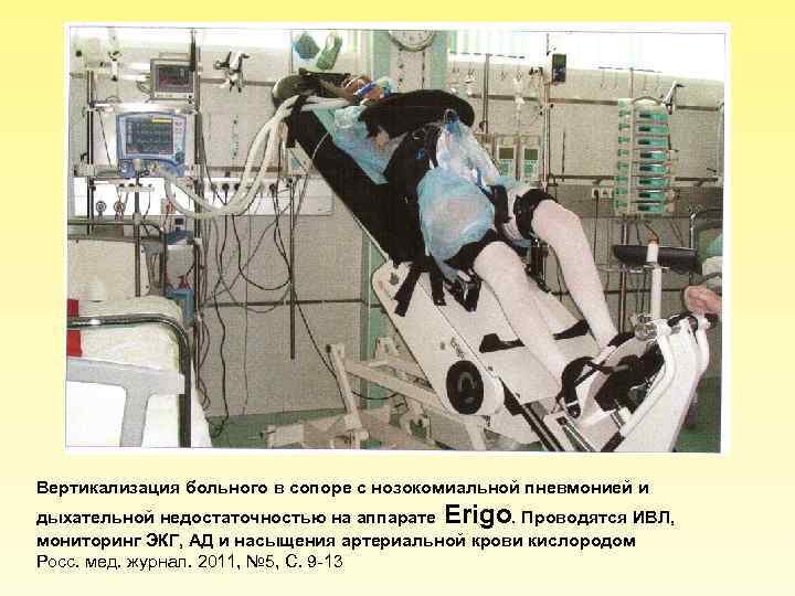 Вертикализация больного в сопоре с нозокомиальной пневмонией и дыхательной недостаточностью на аппарате Erigo. Проводятся